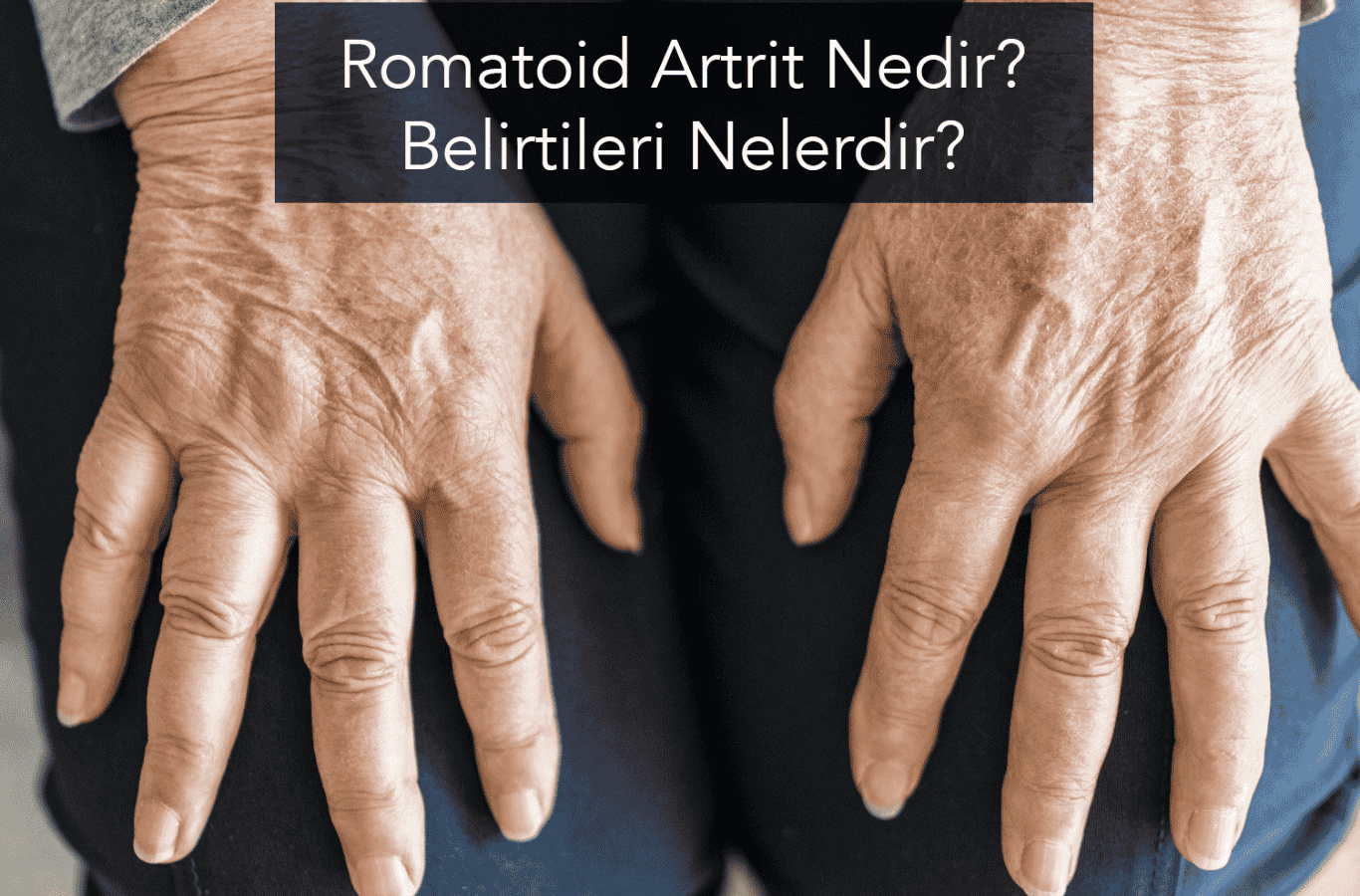 Romatoid Artrit Nedir? Belirtileri Nelerdir?