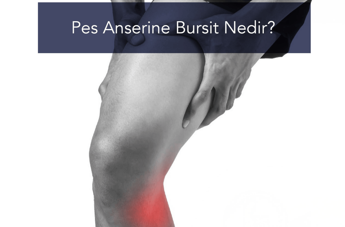 Pes Anserine Bursit Nedir?