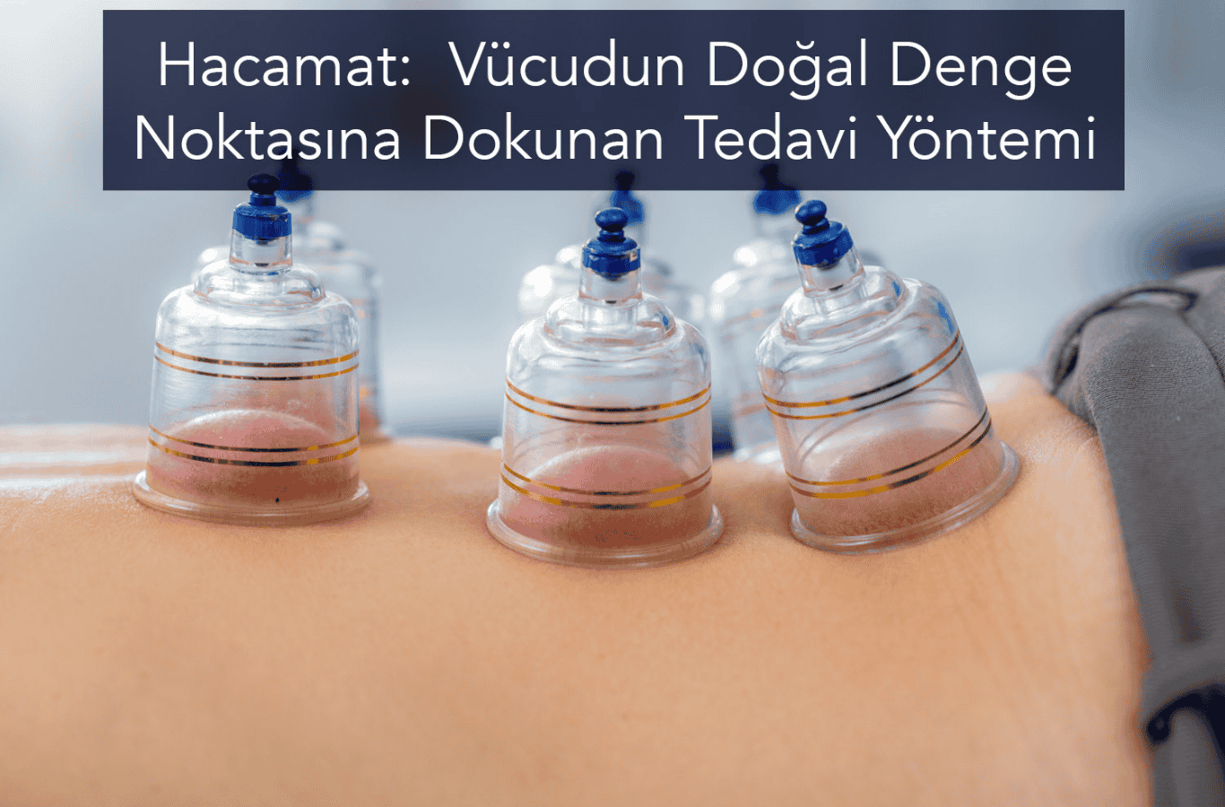Hacamat: Vücudun Doğal Denge Noktasına Dokunan Tedavi Yöntemi