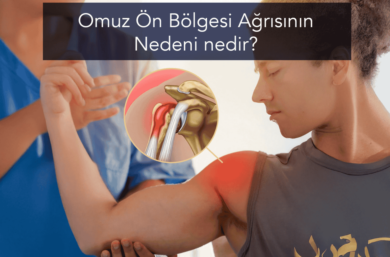 Omuz Ön Bölgesi Ağrısının Nedeni Nedir?